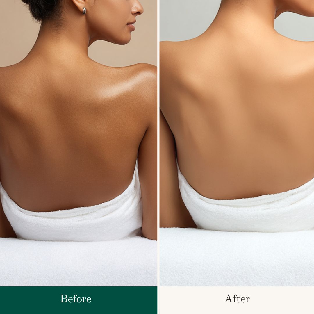 Before After 13